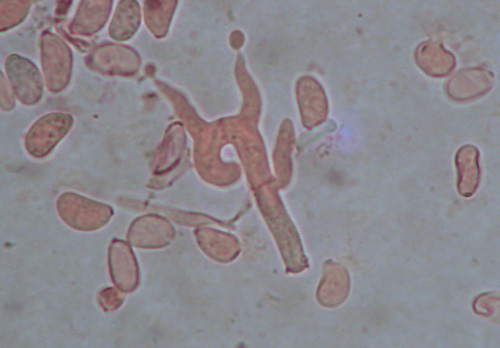Helicobasidium purpureum